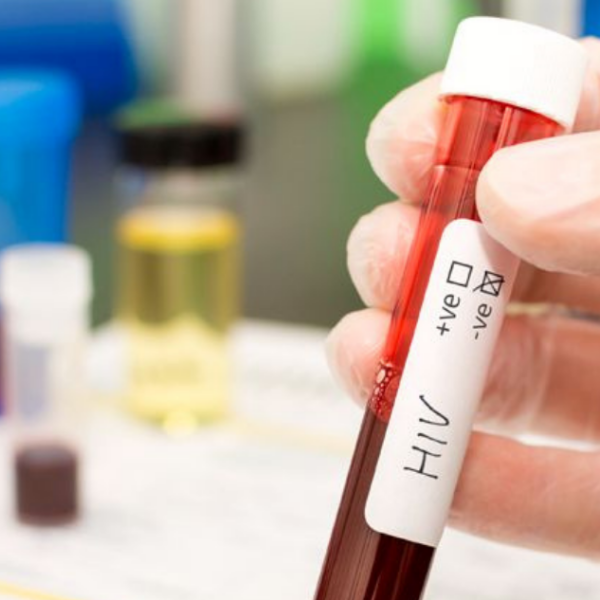 Más de 21 mil personas diagnosticadas con VIH no reciben tratamiento en Chile