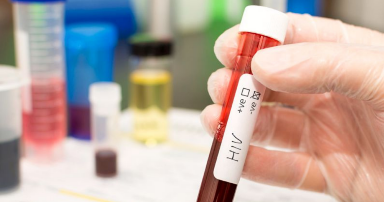 Más de 21 mil personas diagnosticadas con VIH no reciben tratamiento en Chile