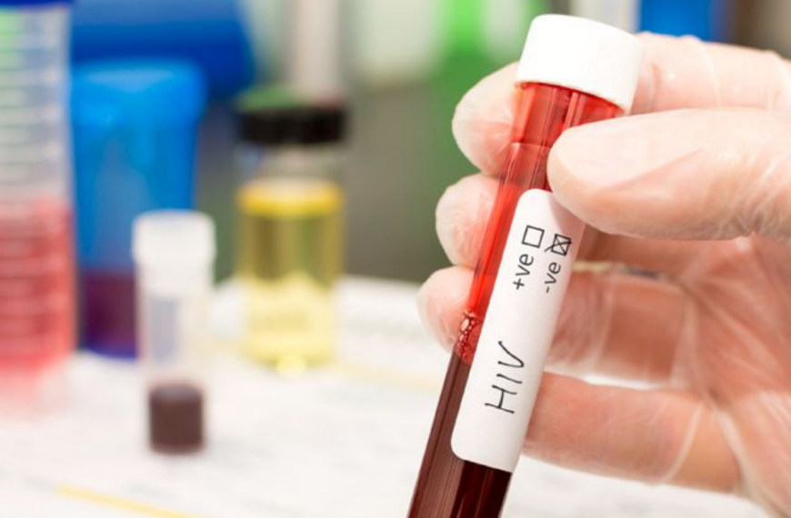 Más de 21 mil personas diagnosticadas con VIH no reciben tratamiento en Chile